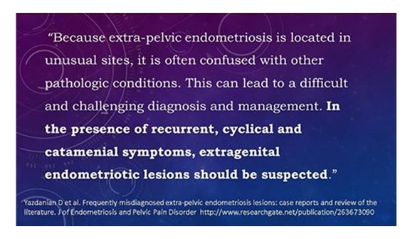 BewareCatamenialSymptomsExtraPelvicDisease