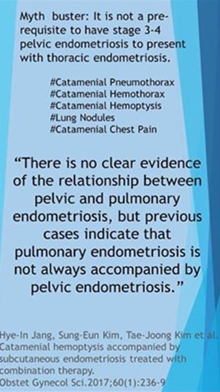 MythTEonlyoccurswithadvancedpelvicdisease