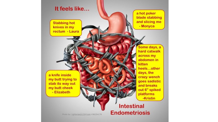 Bowel Endo Quotes 1 It Feels Like