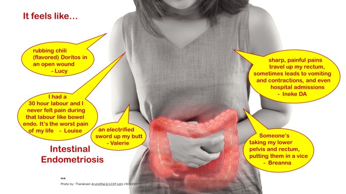 Quotes Analogy Bowel 3 Final
